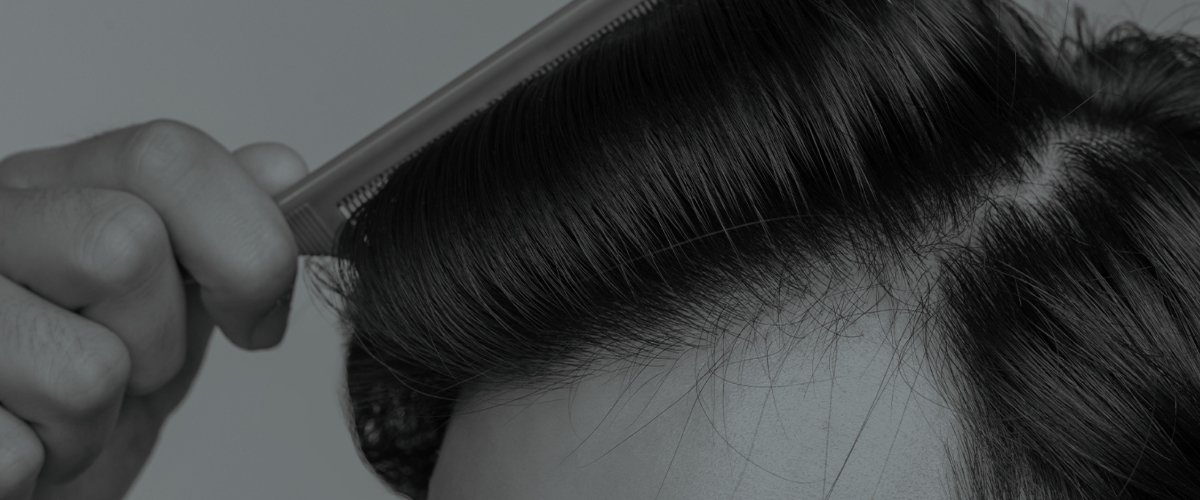 Clinique De Paris - Asian hairline with high density and natural result