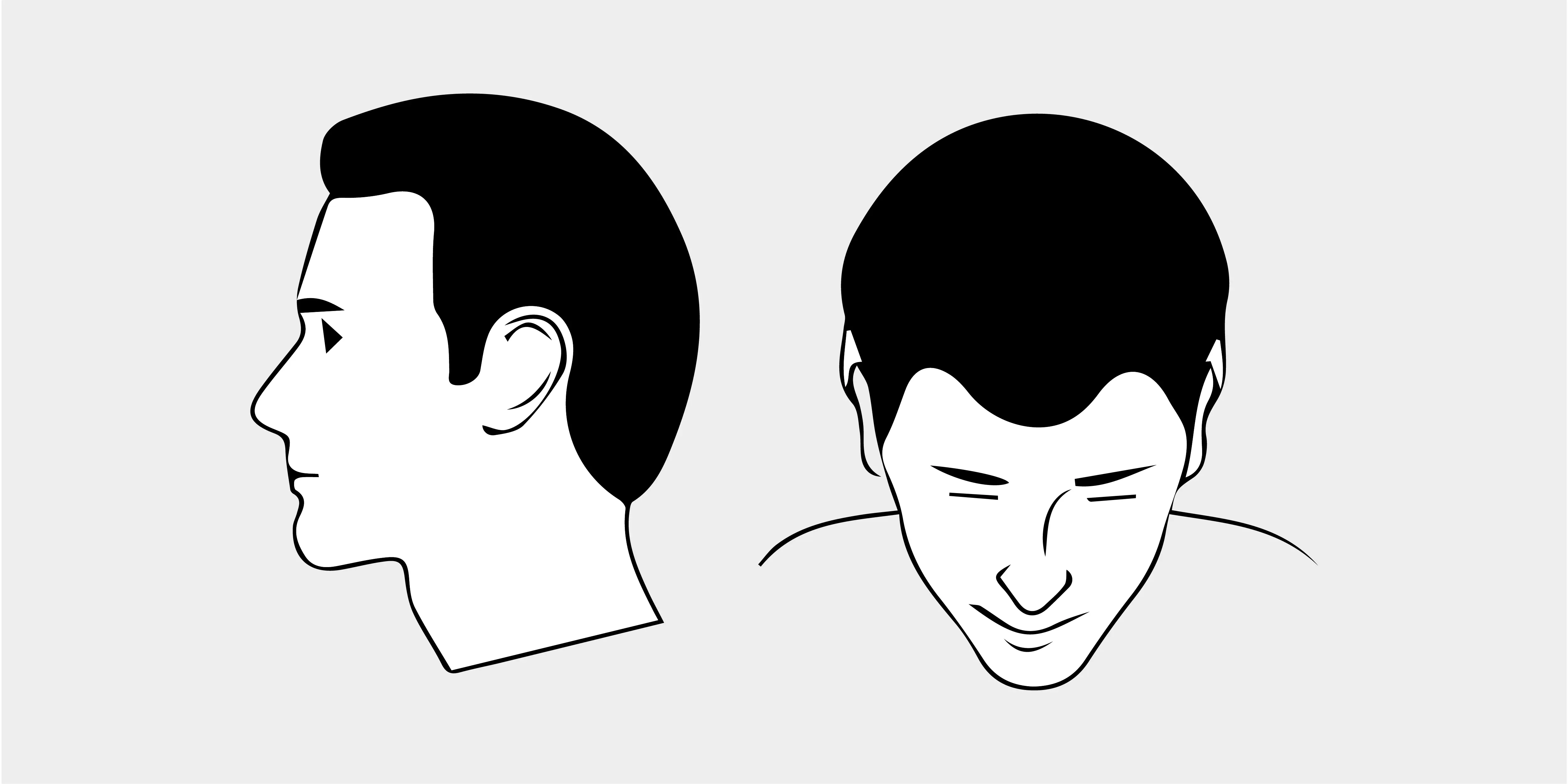 The Norwood Scale