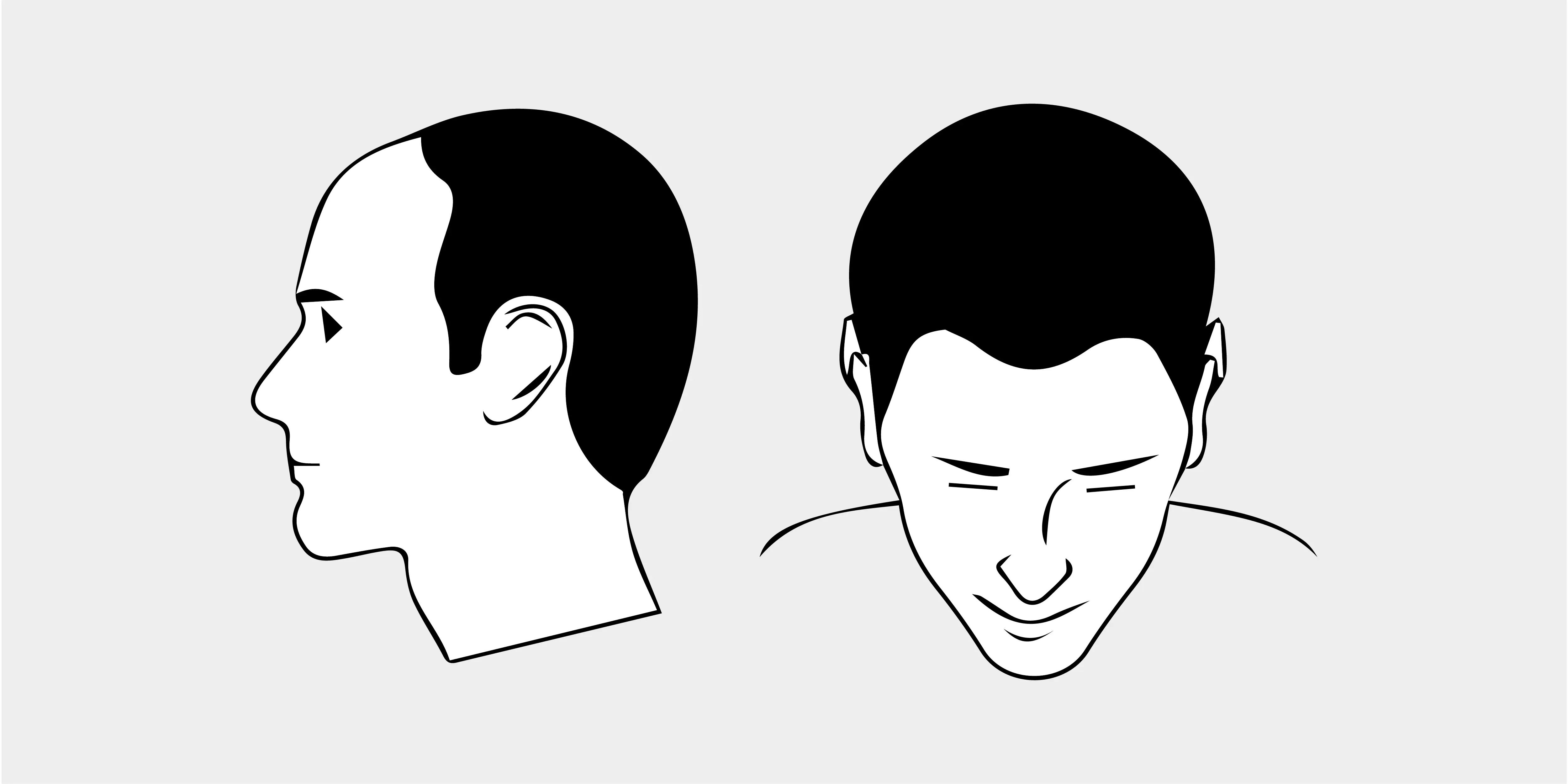 The Norwood Scale