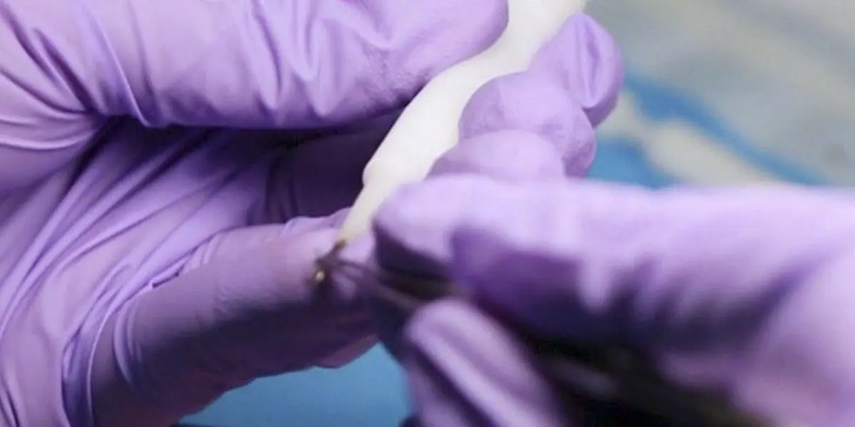 Hair implanter Choi pain for DHI hair transplant