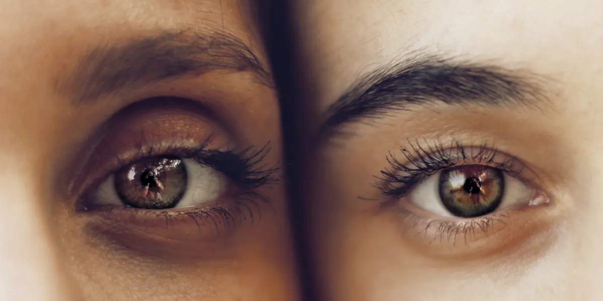 Eyebrow transplant for men and women at Clinique de Paris in the Philippines