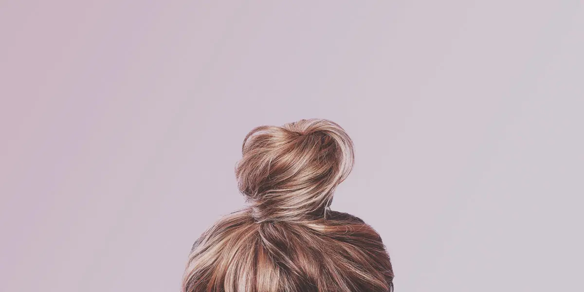 Female hair loss and female hair transplant technique