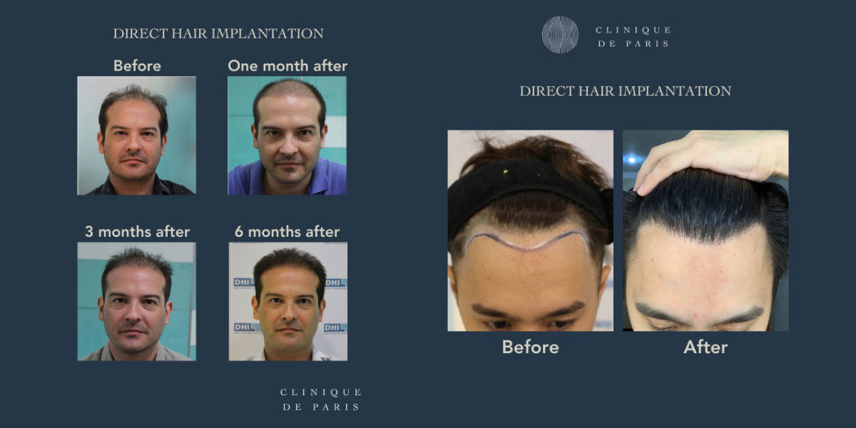 Clinique De Paris - Media & Articles