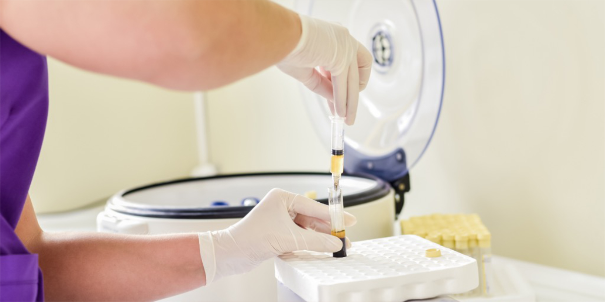 medical staff doing the PRP from centrifuge