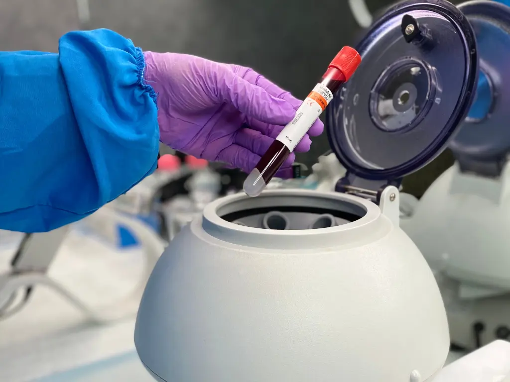 PRP is centrifuged to isolate the platelets from the red blood cells