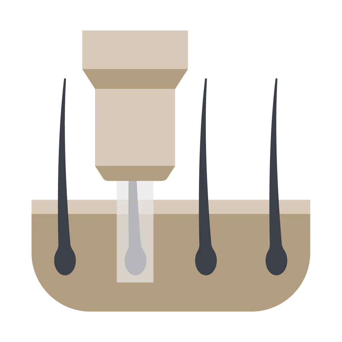 Direct Hair implantation to control angle, density and direction 